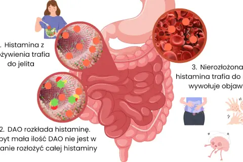 Ilustracja wyjaśnia, jak histamina z pożywienia wpływa na organizm, prowadząc do objawów. Kluczowa jest dieta antyhistaminowa.
